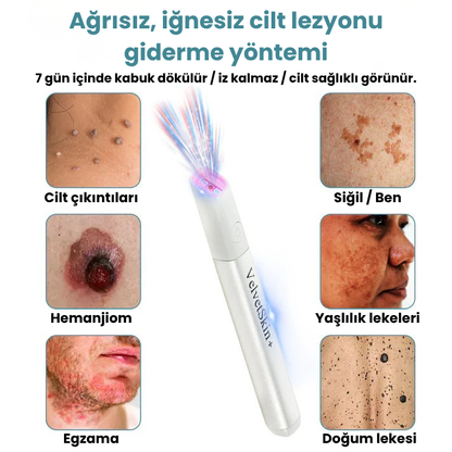 VelvetSkin+™ Hepsi Bir Arada CO₂ Lazer Silici Kalem | Benleri, Siğilleri, Cilt Kusurlarını ve Pigmentasyonları Giderir