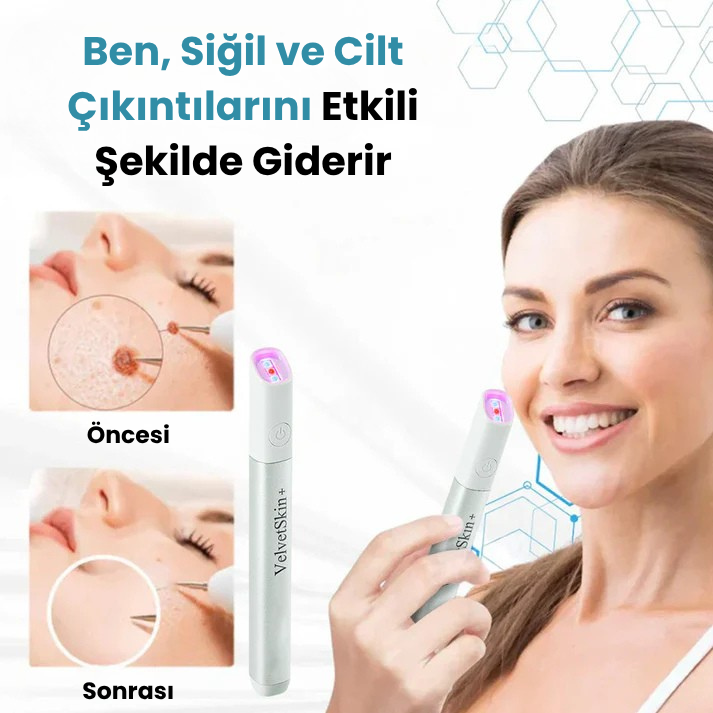 VelvetSkin+™ Hepsi Bir Arada CO₂ Lazer Silici Kalem | Benleri, Siğilleri, Cilt Kusurlarını ve Pigmentasyonları Giderir