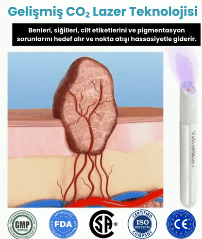 VelvetSkin+™ Hepsi Bir Arada CO₂ Lazer Silici Kalem | Benleri, Siğilleri, Cilt Kusurlarını ve Pigmentasyonları Giderir